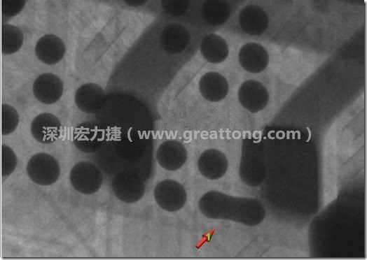 BGA因?yàn)楹笁|變小，造成錫膏過多而最終形成焊接短路的結(jié)果。